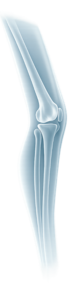 X-ray-style Image of a Forearm with Radius and Ulna Extending into the Elbow Joint from the Side.