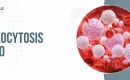 Leukocytosis Icd 10 | Medmax Rcm